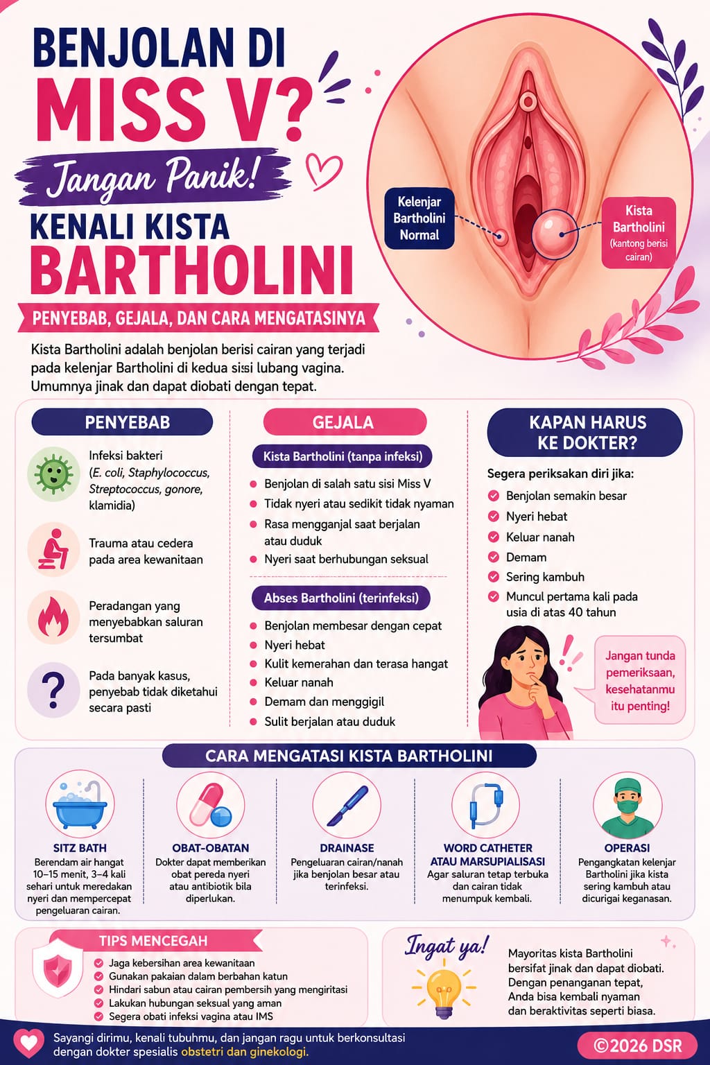 Benjolan pada Vagina kista Bartholin Kista Bartholin