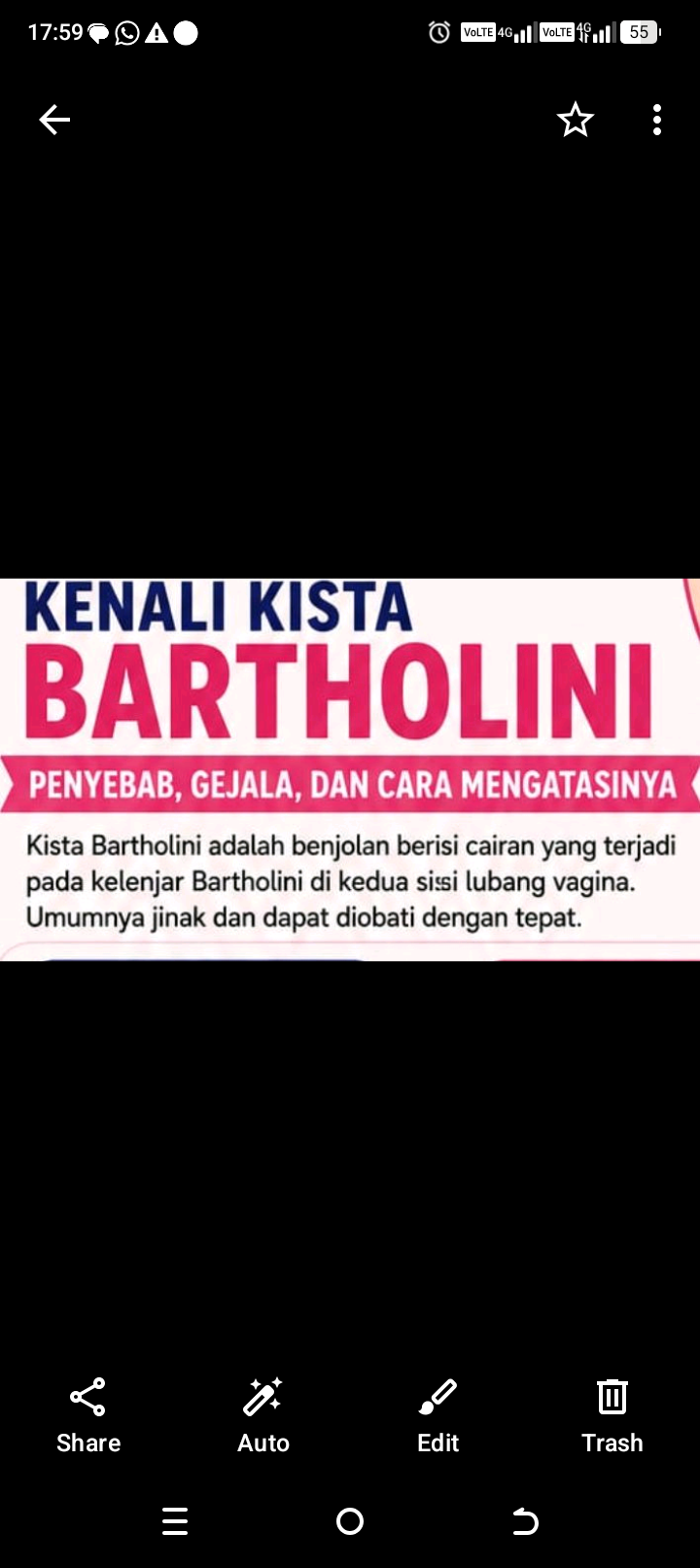 Ada Benjolan di Miss V? Jangan Panik! Kenali Kista Bartholin, Penyebab, Gejala, dan Cara Mengatasinya